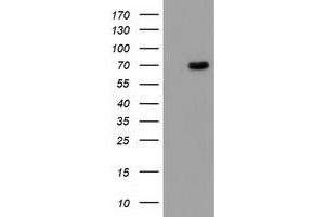 Western Blotting (WB) image for anti-Butyrylcholinesterase (BCHE) antibody (ABIN1496836) (Butyrylcholinesterase 抗体)