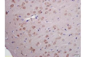 Formalin-fixed and paraffin embedded rat brain labeled with Rabbit Anti-RNA polymerase II CTD repeat YSPTSPS (Ser2) Polyclonal Antibody, Unconjugated (ABIN718391) at 1:200 followed by conjugation to the secondary antibody and DAB staining (RNA Polymerase 2 (pSer2) 抗体)