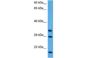 Host:  Mouse  Target Name:  FHL1  Sample Tissue:  Mouse Skeletal Muscle  Antibody Dilution:  1ug/ml (FHL1 抗体  (C-Term))