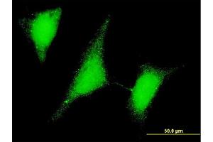 Immunofluorescence of monoclonal antibody to UBE2W on HeLa cell. (UBE2W 抗体  (AA 17-112))
