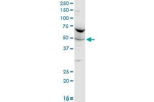 FARSLA polyclonal antibody (A01), Lot # 060102JC01. (Phenylalanyl-tRNA Synthetase, alpha Subunit (FARSA) (AA 101-201) 抗体)