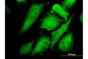 Immunofluorescence of monoclonal antibody to MAPK12 on HeLa cell. (MAPK12 抗体  (AA 251-367))