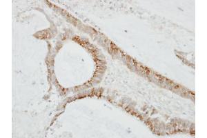 IHC-P Image Immunohistochemical analysis of paraffin-embedded TW2. (CMTM6 抗体  (C-Term))