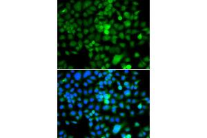 Immunofluorescence analysis of A549 cells using NAP1L3 antibody (ABIN5974335). (NAP1L3 抗体)