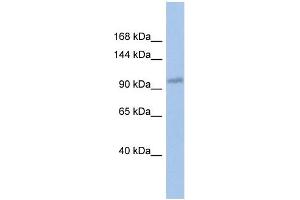 WB Suggested Anti-DDX24 Antibody Titration:  0. (DDX24 抗体  (Middle Region))