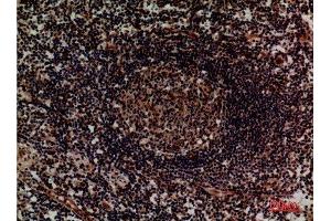 Immunohistochemistry (IHC) analysis of paraffin-embedded Human Lymph, antibody was diluted at 1:100. (ITGA4 抗体  (Internal Region))