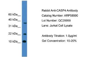 WB Suggested Anti-CASP4  Antibody Titration: 0. (Caspase 4 抗体  (Middle Region))