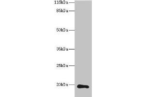 Western blot All lanes: RAB30 antibody at 1 μg/mL + Hela whole cell lysate Secondary Goat polyclonal to rabbit IgG at 1/10000 dilution Predicted band size: 24, 19 kDa Observed band size: 19 kDa (RAB3A 抗体  (AA 1-200))