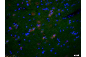 Formalin-fixed and paraffin-embedded rat brain labeled with Anti-GluR1/AMPA Polyclonal Antibody, Unconjugated (ABIN1385842) 1:200, overnight at 4°C, The secondary antibody was Goat Anti-Rabbit IgG, Cy3 conjugated used at 1:200 dilution for 40 minutes at 37°C. (GluR1, GluR2 抗体  (AA 141-240))