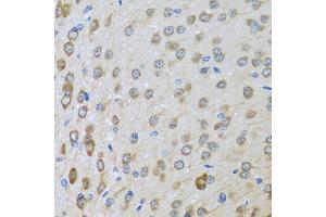 Immunohistochemistry of paraffin-embedded rat brain using BTD antibody (ABIN6127510, ABIN6137680, ABIN6137682 and ABIN6221882) at dilution of 1:100 (40x lens). (BTD 抗体  (AA 284-543))