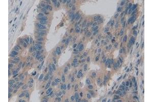 Immunohistochemistry (IHC) image for anti-Pyruvate Kinase M2 (PKM2) (AA 294-470) antibody (ABIN7438913)