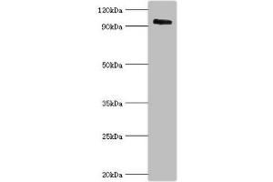 Western blot All lanes: Calpain-3 antibody at 5 μg/mL + Mouse brain tissue Secondary Goat polyclonal to rabbit IgG at 1/10000 dilution Predicted band size: 95, 85, 94, 36, 19 kDa Observed band size: 95 kDa (Calpain 3 抗体  (AA 582-821))
