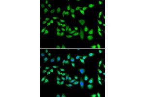 Immunofluorescence (IF) image for anti-DnaJ (Hsp40) Homolog, Subfamily B, Member 6 (DNAJB6) (AA 177-326) antibody (ABIN6139713)