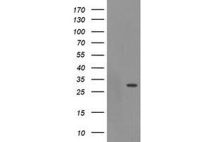 Western Blotting (WB) image for anti-Exosome Component 3 (EXOSC3) antibody (ABIN1498139) (EXOSC3 抗体)