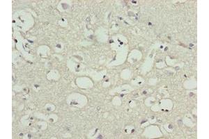 Immunohistochemistry of paraffin-embedded human brain tissue using ABIN7165213 at dilution of 1:100 (CNIH3 抗体  (AA 94-138))