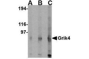 Western blot analysis of Grik4 in rat brain lysate with Grik4 antibody at (A) 0. (GRIK4 抗体  (C-Term))