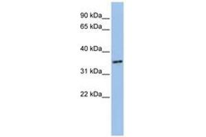Image no. 1 for anti-PHD Finger Protein 13 (PHF13) (AA 36-85) antibody (ABIN6741099) (PHF13 抗体  (AA 36-85))