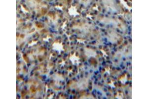 Used in DAB staining on fromalin fixed paraffin-embedded kidney tissue (SOCS3 抗体  (AA 1-225))