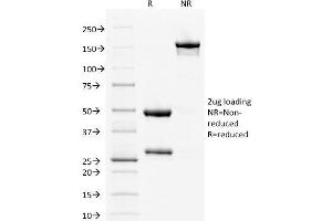 SDS-PAGE (SDS) image for anti-Estrogen Receptor 1 (ESR1) antibody (ABIN6939339)