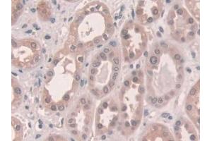 Immunohistochemistry (IHC) image for anti-Gap Junction Protein, alpha 1, 43kDa (GJA1) (AA 244-382) antibody (ABIN7431497)