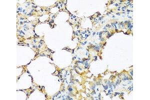 Immunohistochemistry of paraffin-embedded Mouse lung using TSHB Polyclonal Antibody at dilution of 1:100 (40x lens). (TSHB 抗体)
