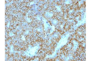 Formalin-fixed, paraffin-embedded human Parathyroid Gland stained with PTH Mouse Monoclonal Antibody (PTH/1175). (PTH 抗体  (AA 32-115))