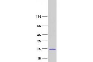 Western Blotting (WB) image for Claudin 19 (CLDN19) (Transcript Variant 2) protein (Myc-DYKDDDDK Tag) (ABIN2712854)