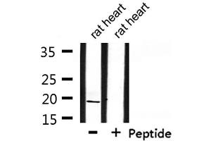 Western blot analysis of extracts from rat heart, using INSL4 Antibody. (INSL4 抗体)