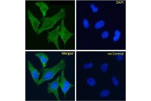 Immunofluoresence staining of fixed HeLa cells with anti-TrkA antibody MNAC13.