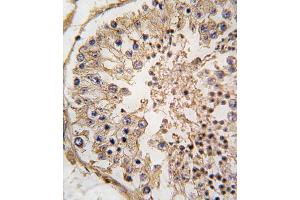Immunohistochemistry (IHC) image for anti-B-Cell CLL/lymphoma 2 (BCL2) (BH3 Domain) antibody (ABIN2997097)
