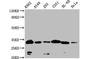 Western Blot Positive WB detected in: K562 whole cell lysate,A549 whole cell lysate,293 whole cell lysate,U251 whole cell lysate,HL-60 whole cell lysate,Hela whole cell lysate All lanes: VDAC3 antibody at 1:1000 Secondary Goat polyclonal to rabbit IgG at 1/50000 dilution Predicted band size: 31 kDa Observed band size: 32 kDa (VDAC3 抗体  (AA 40-160))