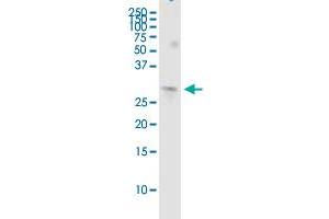 COMT (Human) IP-WB Antibody Pair