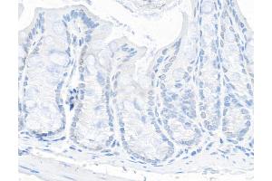 Immunohistochemistry (IHC) image for anti-Tripartite Motif Containing 24 (TRIM24) (AA 700-750) antibody (ABIN7454678) (TRIM24 抗体  (AA 700-750))