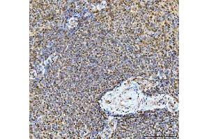 IHC analysis of TIGD1 using anti-TIGD1 antibody (ABIN7602407).