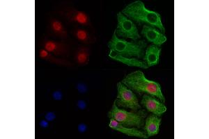 ABIN6260261 and ABIN6269348 staining Hela cells by IF/ICC. (BIK 抗体  (N-Term))