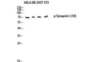 Western Blot (WB) analysis of HeLa KB 293T 3T3 lysis using Phospho-Synapsin I (S9) antibody. (SYN1 抗体  (pSer9))