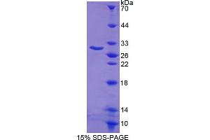 SDS-PAGE analysis of Human Bcl2L Protein. (BCL2L1 蛋白)