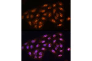Immunofluorescence analysis of U2OS cells using [KO Validated] PPP1CC Rabbit pAb (ABIN1682257, ABIN3018437, ABIN3018438 and ABIN5664595) at dilution of 1:100 (40x lens). (PPP1CC 抗体  (AA 1-323))