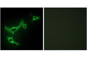 Immunofluorescence analysis of NIH-3T3 cells, using TRIM3 Antibody. (TRIM3 抗体  (AA 1-50))