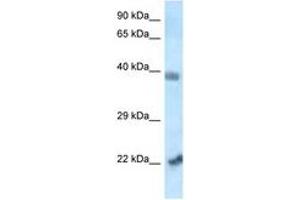 Image no. 1 for anti-Vacuolar Protein Sorting 72 Homolog (S. Cerevisiae) (VPS72) (N-Term) antibody (ABIN6747513)