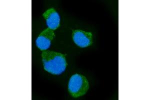 IF analysis of Epac1/RAPGEF3 using anti-Epac1/RAPGEF3 antibody (ABIN7601858).