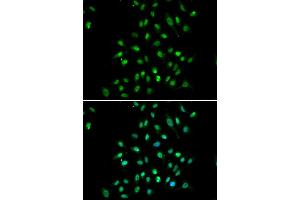 Immunofluorescence analysis of A549 cells using CXXC1 antibody. (CXXC1 抗体)