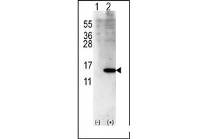Image no. 1 for anti-ISG15 Ubiquitin-Like Modifier (ISG15) (Middle Region) antibody (ABIN356681) (ISG15 抗体  (Middle Region))
