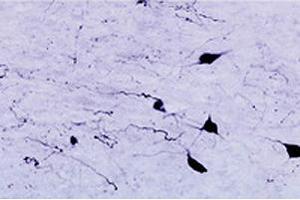 Immunohistochemical staining of HCRTR1 in rat zona incerta neurons using HCRTR1 polyclonal antibody , at a dilution of 1 : 1000.
