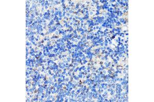 Immunohistochemistry of paraffin-embedded mouse spleen using Filamin A antibody (ABIN7267206) at dilution of 1:100 (40x lens). (Filamin A 抗体  (C-Term))