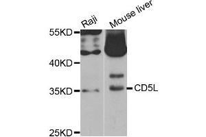 Western Blotting (WB) image for anti-CD5 Molecule-Like (CD5L) antibody (ABIN1882350) (CD5L 抗体)