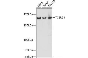 Western blot analysis of extracts of various cell lines using TCERG1 Polyclonal Antibody at dilution of 1:1000. (TCERG1 抗体)