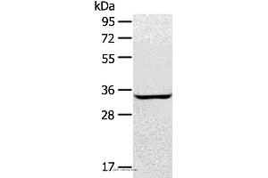 Western blot analysis of A172 cell, using STX2 Polyclonal Antibody at dilution of 1:400 (STX2 抗体)