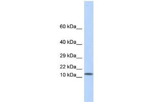 WB Suggested Anti-LGALS1 Antibody Titration: 0.