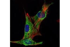 Immunofluorescence analysis of PANC-1 cells using INHA antibody (green). (Inhibin alpha 抗体)